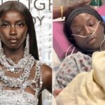 Supermodel Anok Yai Opens Up About Being Diagnosed With A Congenital Defect