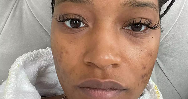 Keke Palmer Says Her Childhood Was The “Darkest” Time Of Her Life And That Fame Traumatized Her